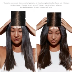 Sérum Cellulaire Nuit Anti-Pelliculaire Intensif Symbiose Kérastase -Magasin de cheveux Sans titre 350 350 px 500 500 px 280 280 px 140 140 px 350 350 px 1200 1200 px 19 31693.1684847701